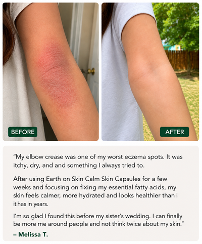 Earth on Skin -  Calm Skin Capsule