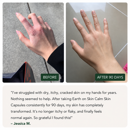 Earth on Skin -  Calm Skin Capsule